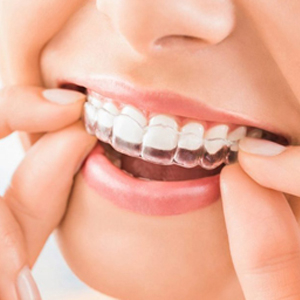 How Invisalign in Ramsey Can Transform Your Smile